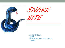 Snake Bite Management