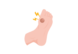 foot blister