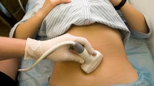 Image result for mother gets ultrasound of baby