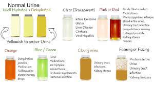 red urine green urine cloudy urine