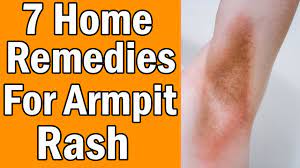 7 home remes for armpit rash you