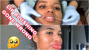 lip tattooing gone wrong shocking