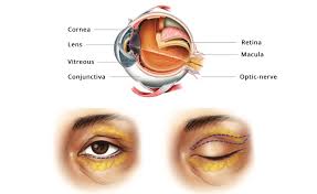 eye treatments in singapore
