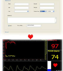 Finger Pulse Oximeter With Alarm And Perfusion Index Pi