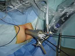 Résultat de recherche d'images pour "rectoscope"