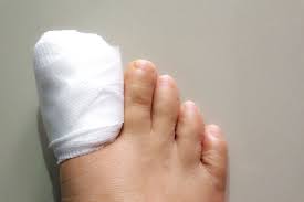 stubbed toe is it serious symptoms