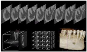 radiation and cbct in dental practice