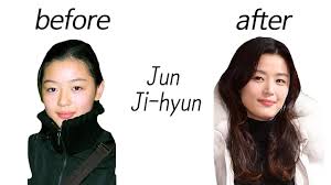 Their love flourished from there. Jun Ji Hyun Before And After Youtube