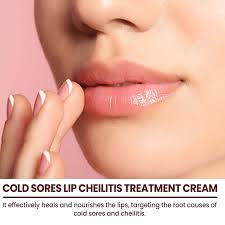 makeup lip herpes and cheilitis cream