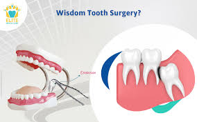 is wisdom tooth removal a major surgery