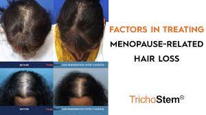 treating factors of menopause hair loss