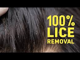 home remes for lice nits
