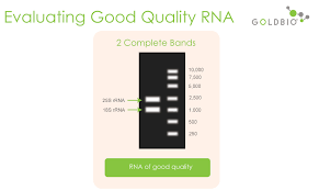 qc your rna using gel electropsis