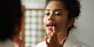 dry lips and how to treat dry ed lips