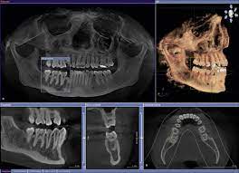 3 d x ray michael macinnes dds pllc