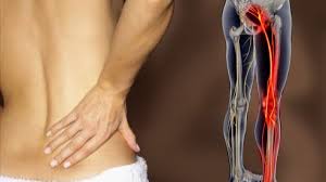 back pain and leg crs