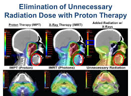 proton therapy radiation oncology