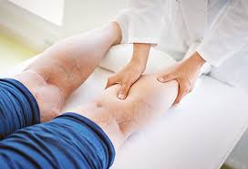 varicose veins treatments causes pain