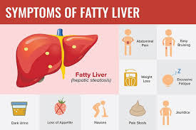 how nash and fatty liver effects daily
