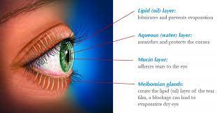 dry eye relief ipl optometrist