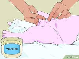 Your baby has a fever over 38°c. How To Clean A Circumcision 15 Steps With Pictures Wikihow Mom