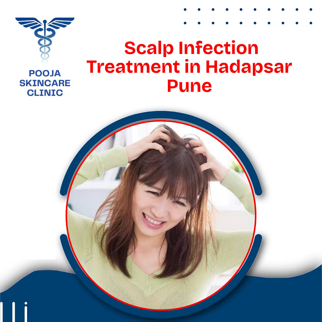 Scalp Infection Treatment in Hadapsar Pune product image