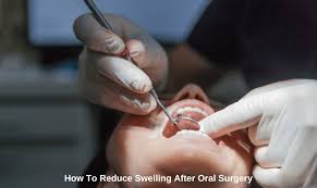 reduce swelling after surgery