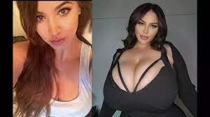 OnlyFans Model's Breasts Grow 6 Cup Sizes in 14 Months Due to Rare  Condition | Viral News, Times Now