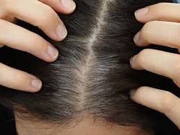 folliculitis treatment causes and