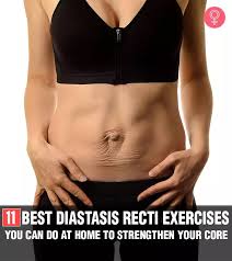 11 exercises for diastasis recti that