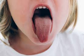 what causes tingling tongue signs of