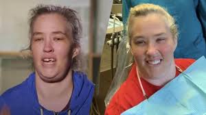 Mama june, as she affectionally came to be known, became a breakout star in her own right, with crazy antics and family drama helping her make her way to fame on reality tv. Mama June Gets Her Teeth Fixed Looks Like A New Woman