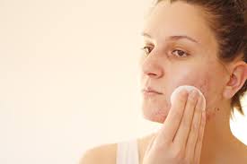 home remes for cystic acne do they