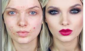 you video from acne make up