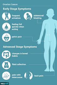 ovarian cancer signs symptoms and