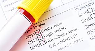 Hdl, or the good cholesterol can help reduce your risk of heart attack and stroke. Sehr Hohe Hdl Werte Sind Moglicherweise Schadlich