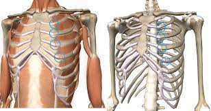 Read about costochondritis symptoms, treatment, causes, prevention, surgery. Rib Pain As Costochondritis Innova Pain Clinic