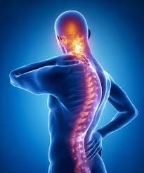 It's sometimes called scheuermann's disease. Scheuermann S Disease Treatment In Fairfax Va Sapna Spine And Pain Clinic Of North America