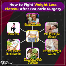 weight loss plateau after gastric