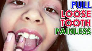 Maybe you would like to learn more about one of these? How To Pull Loose Tooth Out Pulling Wobbly Tooth Painlessly At Home Youtube