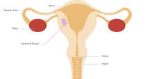 Image result for icd 10 code for myometrial fibroid