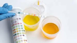 what urine colour tells about your
