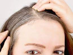 what causes pre gray hair at