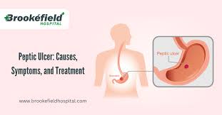 peptic ulcer causes symptoms and