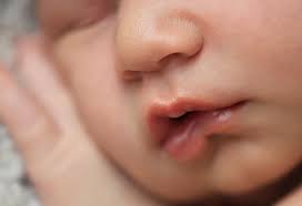 lip tie in newborn es reasons