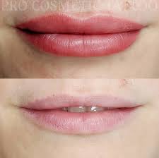 lip tattoos by pro cosmetic tattoo in