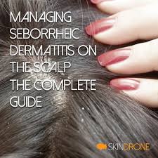 seborrheic dermais on the scalp