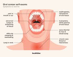 cancer screening importance