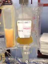 Image result for platelet donation