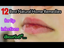 lip infection natural home remes